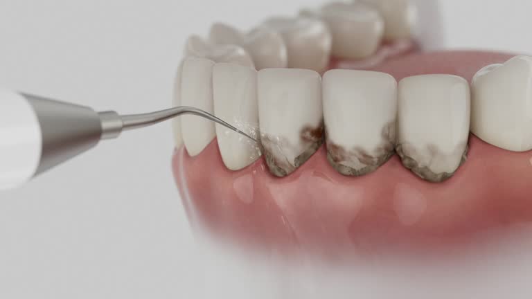 Trusted Tooth Extraction service in Dayton, WA - Dentist Open Now